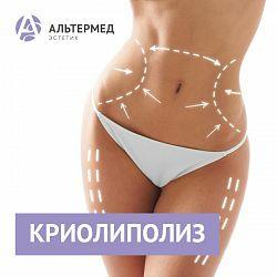 cryolipolysis akcya